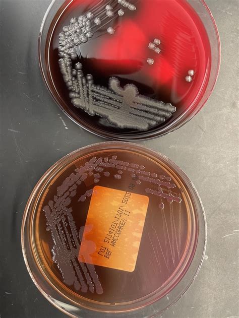 pseudomonas aeruginosa emb|1.28: EMB Agar .